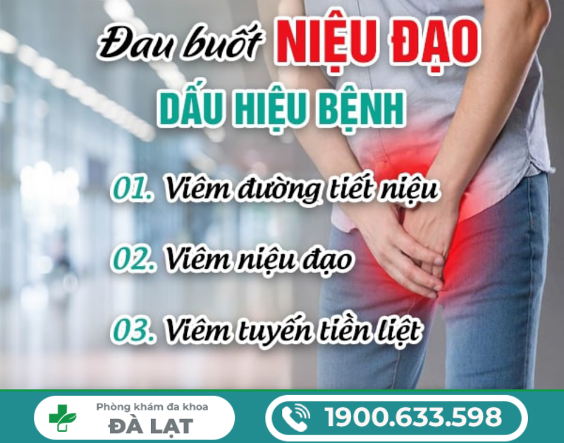 Hình ảnh minh họa